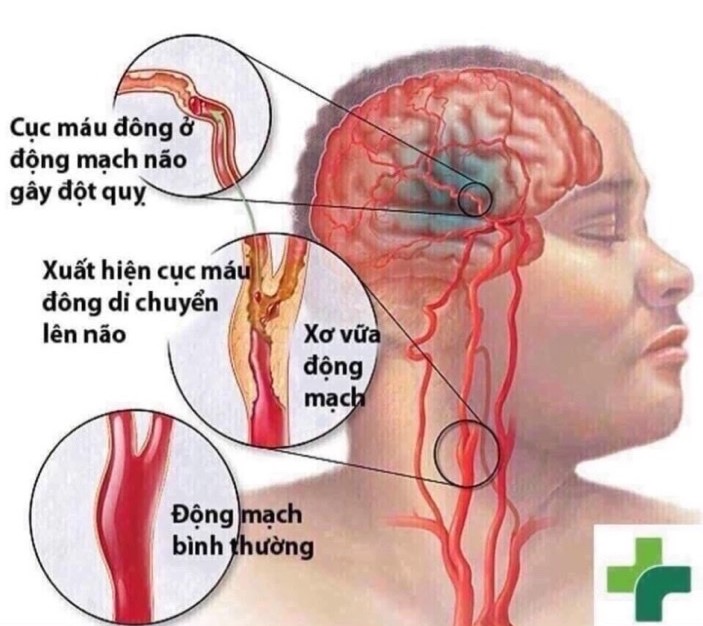 An Cung Ngưu Hoàng Hoàn Tổ Kén Kwangdong Hàn Quốc 10 Viên - Image 2